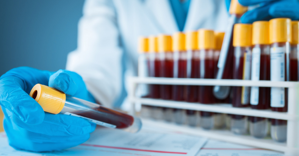 How Accurate Are Routine Laboratory Tests For Diagnosis Of Covid 19 Cochrane